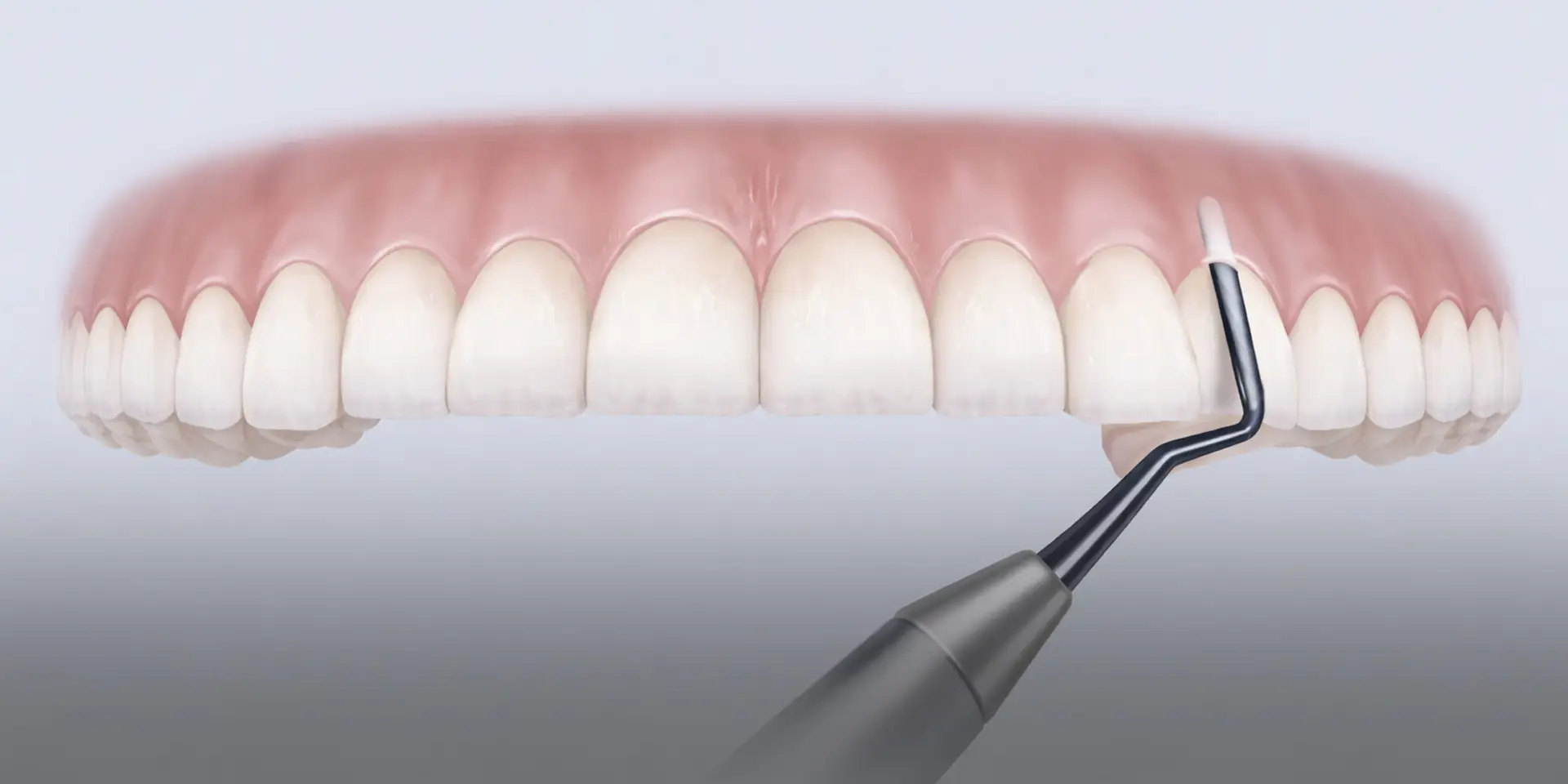 Atraumatic Extractions with Piezoelectric Technology - Periodontist in ...